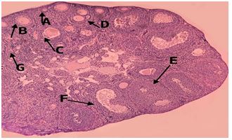 Effect Study of Verbena Ofﬁcinalis Medicinal Herb on Sex Hormones Level of NMRI Female Rats During Pregnancy 